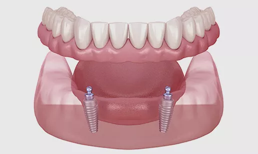 Denture Secure Grey